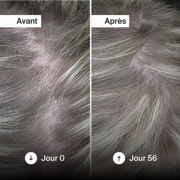 Naali Gummies Cheveux